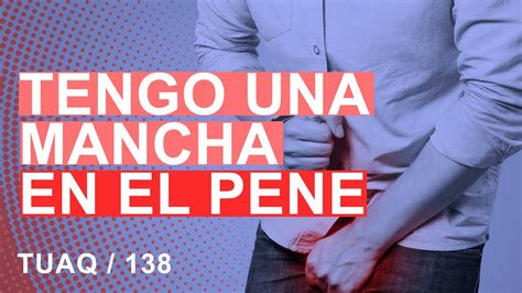 manchas en el pen negras|¿Debería preocuparse por las manchas oscuras en el。